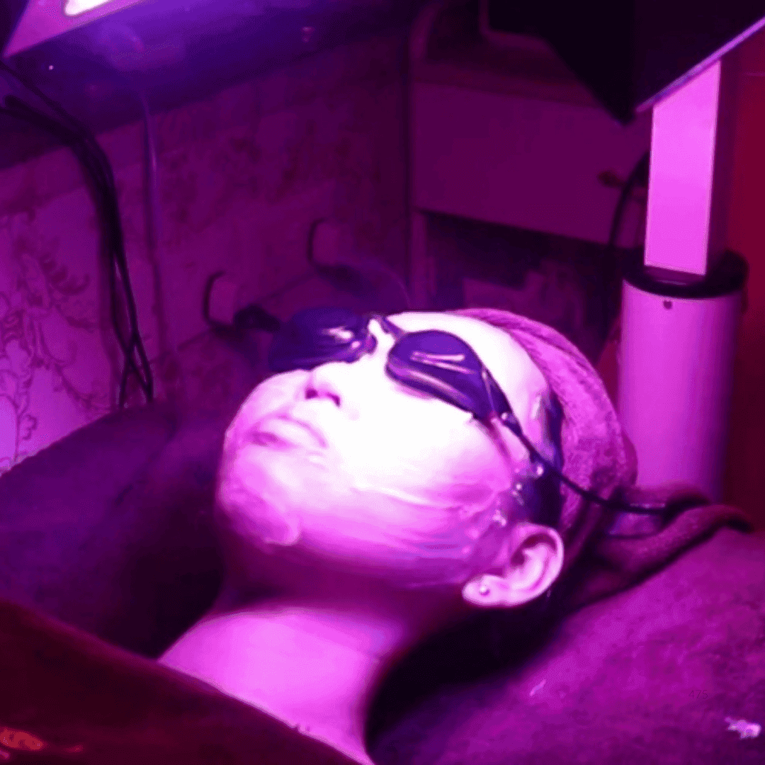 Ultimate Anti-Acne LED Facial Gift Voucher